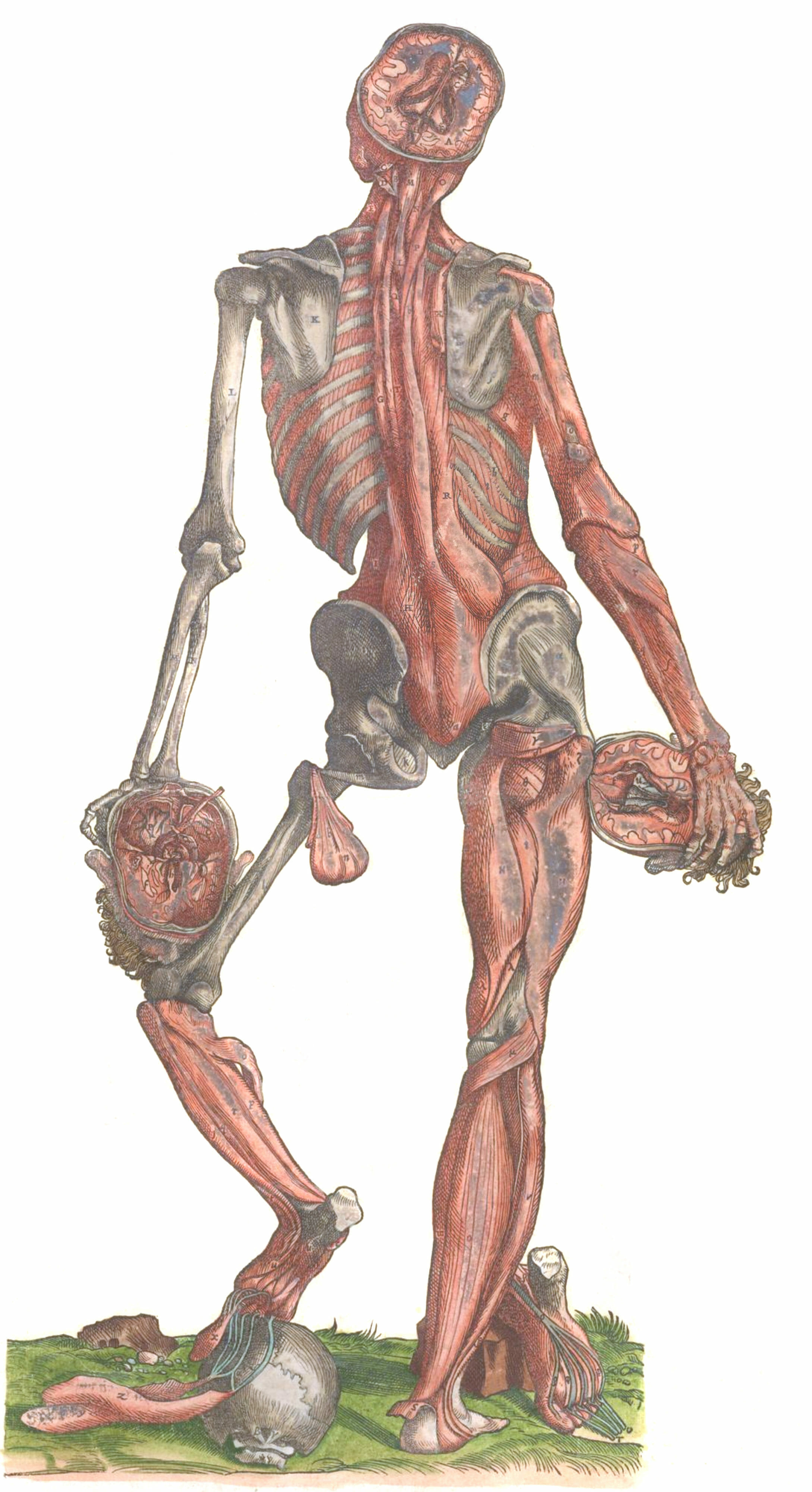 Vintage Anatomy Illustration Skeleton Standing With Muscles Attached Holding A Disected Head