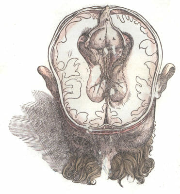 Vintage Illustration Of The Head With A Coss Section The The Brain3