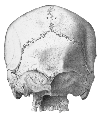 Vintage Skull Illustration Of Human Rear View